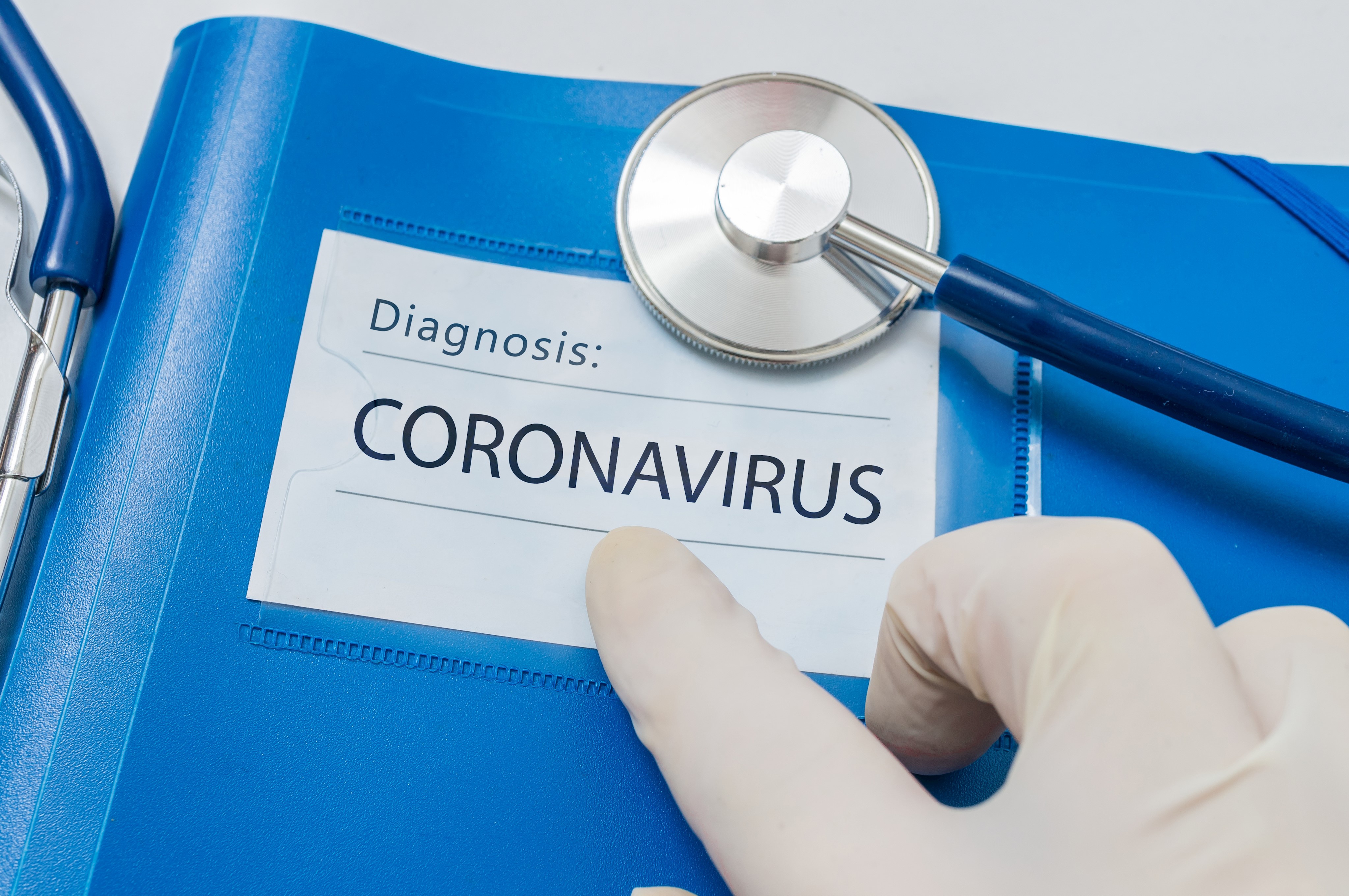 Novel coronavirus disease 2019-nCoV written on blue folder © vchalup - stock.adobe.com.jpeg